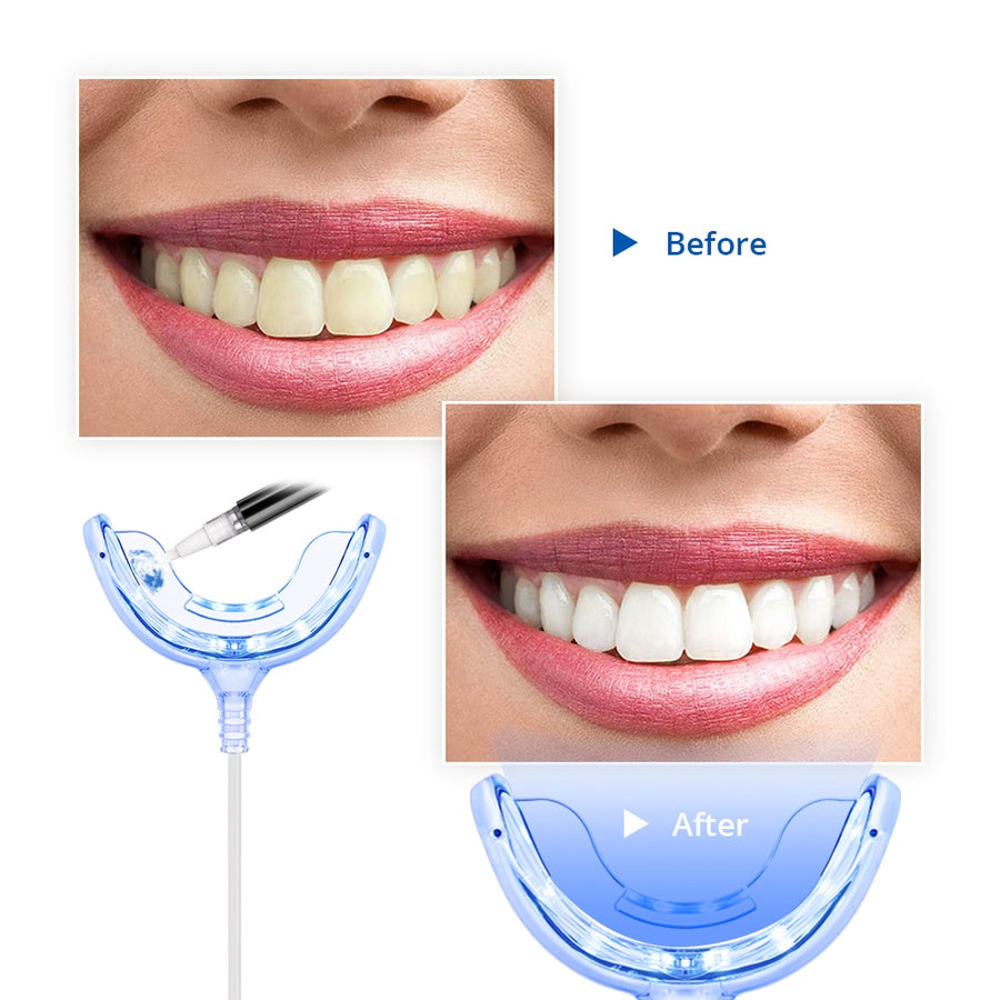 type-c teeth whitening kit