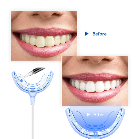 type-c teeth whitening kit